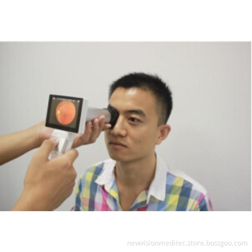 Hand Held Non-Mydriatic Digital Retinal Camera
